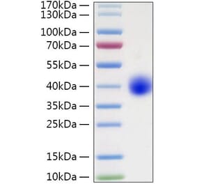 SDS-PAGE - Recombinant Human LILRA5 Protein (C-terminal His Tag) (A331008) - Antibodies.com