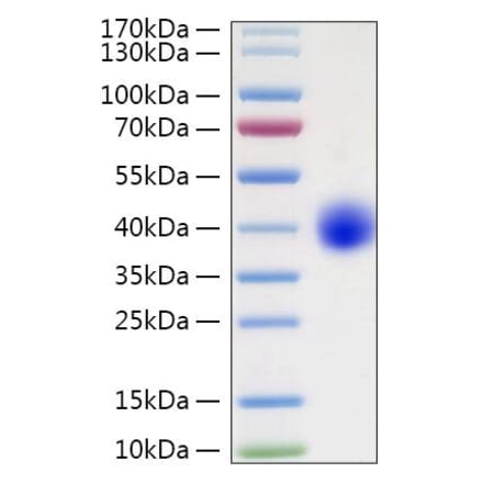 SDS-PAGE - Recombinant Human LILRA5 Protein (C-terminal His Tag) (A331008) - Antibodies.com