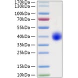SDS-PAGE - Recombinant Human LILRA5 Protein (C-terminal His Tag) (A331008) - Antibodies.com