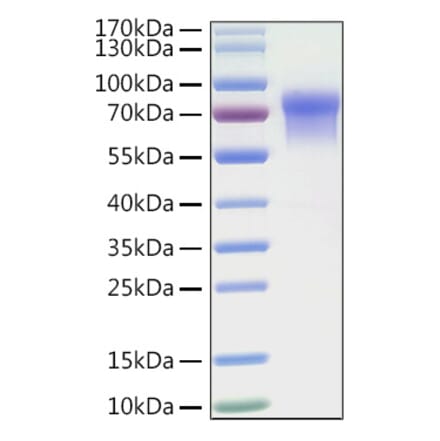 SDS-PAGE - Recombinant Human LILRB1 Protein (C-terminal His Tag) (A331009) - Antibodies.com