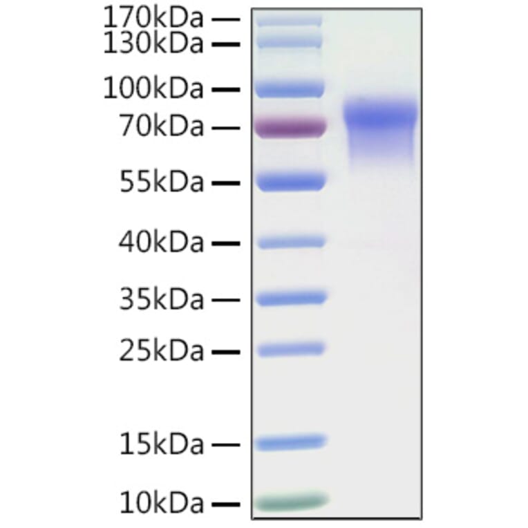 SDS-PAGE - Recombinant Human LILRB1 Protein (C-terminal His Tag) (A331009) - Antibodies.com