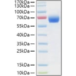 SDS-PAGE - Recombinant Human LILRB3 Protein (C-terminal His and Avi Tag) (A331010) - Antibodies.com