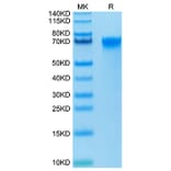 Tris-Bis PAGE - Recombinant Human LILRB3 Protein (Biotin) (C-terminal His and Avi Tag) (A331011) - Antibodies.com