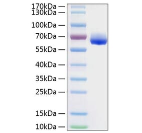 SDS-PAGE - Recombinant Human LILRB4 Protein (C-terminal Human Fc and His Tag) (A331012) - Antibodies.com