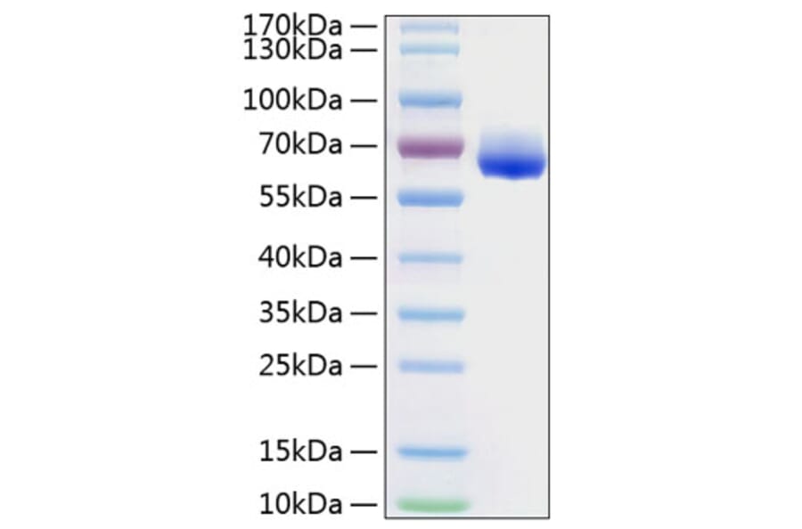 SDS-PAGE - Recombinant Human LILRB4 Protein (C-terminal Human Fc and His Tag) (A331012) - Antibodies.com