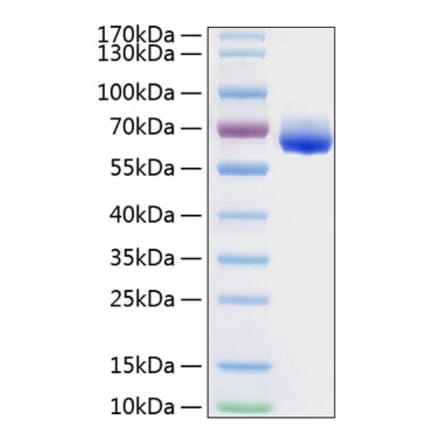 SDS-PAGE - Recombinant Human LILRB4 Protein (C-terminal Human Fc and His Tag) (A331012) - Antibodies.com