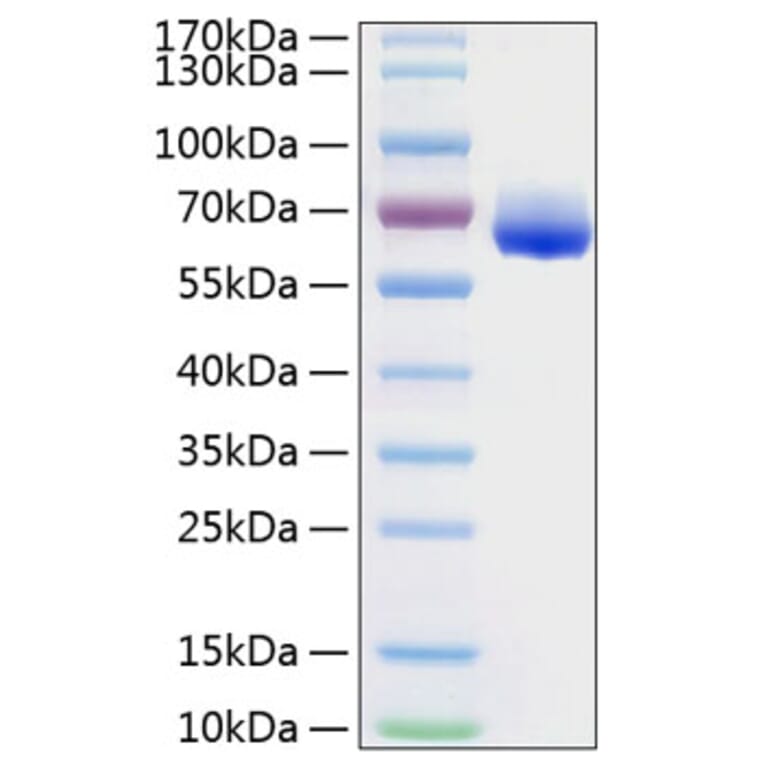 SDS-PAGE - Recombinant Human LILRB4 Protein (C-terminal Human Fc and His Tag) (A331012) - Antibodies.com