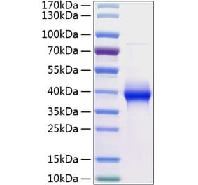 SDS-PAGE - Recombinant Human LILRB4 Protein (C-terminal His Tag) (A331013) - Antibodies.com