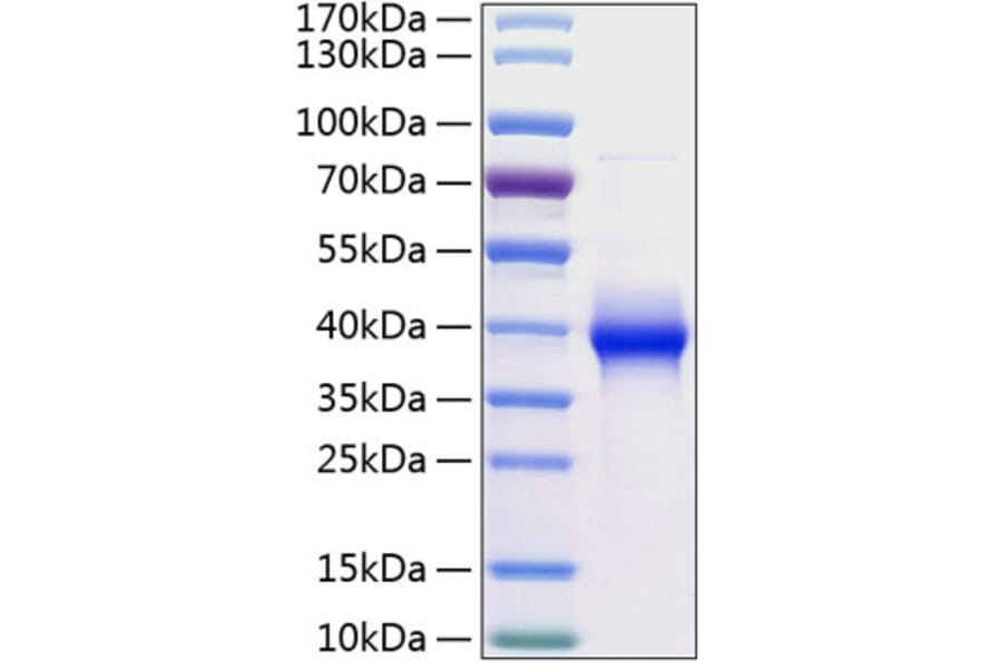 SDS-PAGE - Recombinant Human LILRB4 Protein (C-terminal His Tag) (A331013) - Antibodies.com