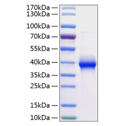 SDS-PAGE - Recombinant Human LILRB4 Protein (C-terminal His Tag) (A331013) - Antibodies.com