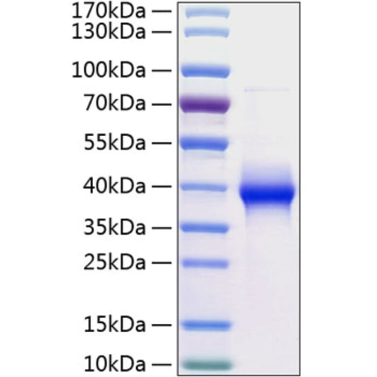 SDS-PAGE - Recombinant Human LILRB4 Protein (C-terminal His Tag) (A331013) - Antibodies.com