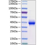 SDS-PAGE - Recombinant Human LILRB4 Protein (C-terminal His Tag) (A331013) - Antibodies.com