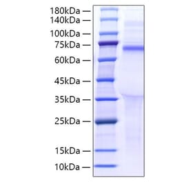 SDS-PAGE - Recombinant Human LILRB5 Protein (C-terminal His Tag) (A331014) - Antibodies.com