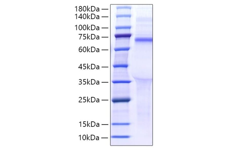 SDS-PAGE - Recombinant Human LILRB5 Protein (C-terminal His Tag) (A331014) - Antibodies.com