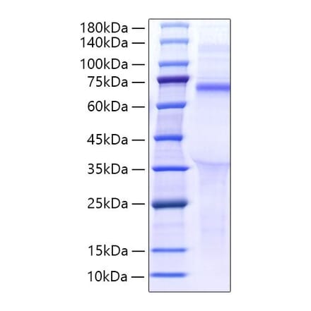 SDS-PAGE - Recombinant Human LILRB5 Protein (C-terminal His Tag) (A331014) - Antibodies.com