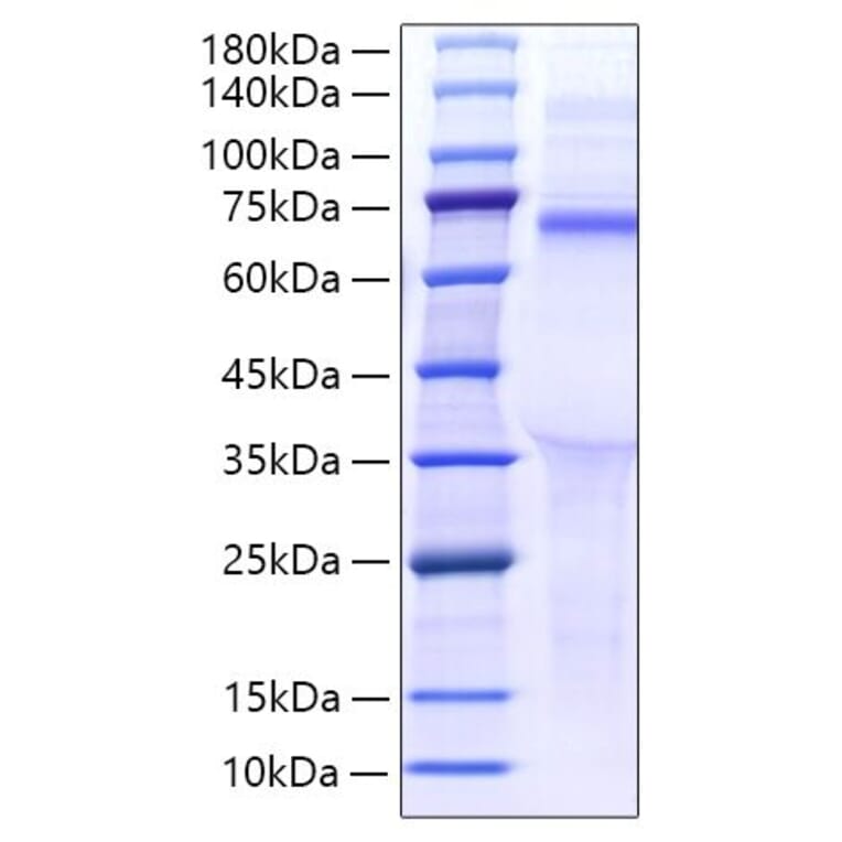 SDS-PAGE - Recombinant Human LILRB5 Protein (C-terminal His Tag) (A331014) - Antibodies.com