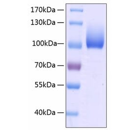 SDS-PAGE - Recombinant Human LIMPII Protein (C-terminal Human Fc and His Tag) (A331015) - Antibodies.com