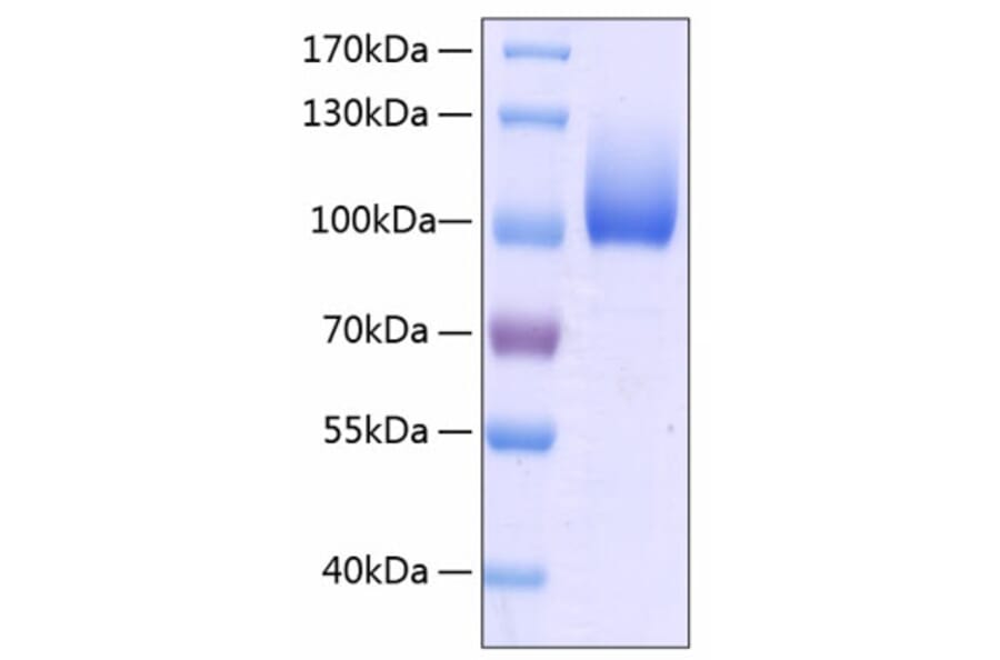 SDS-PAGE - Recombinant Human LIMPII Protein (C-terminal Human Fc and His Tag) (A331015) - Antibodies.com