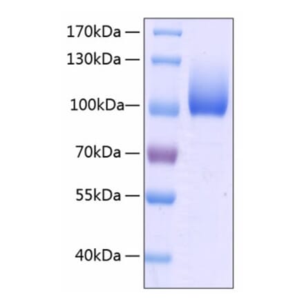 SDS-PAGE - Recombinant Human LIMPII Protein (C-terminal Human Fc and His Tag) (A331015) - Antibodies.com