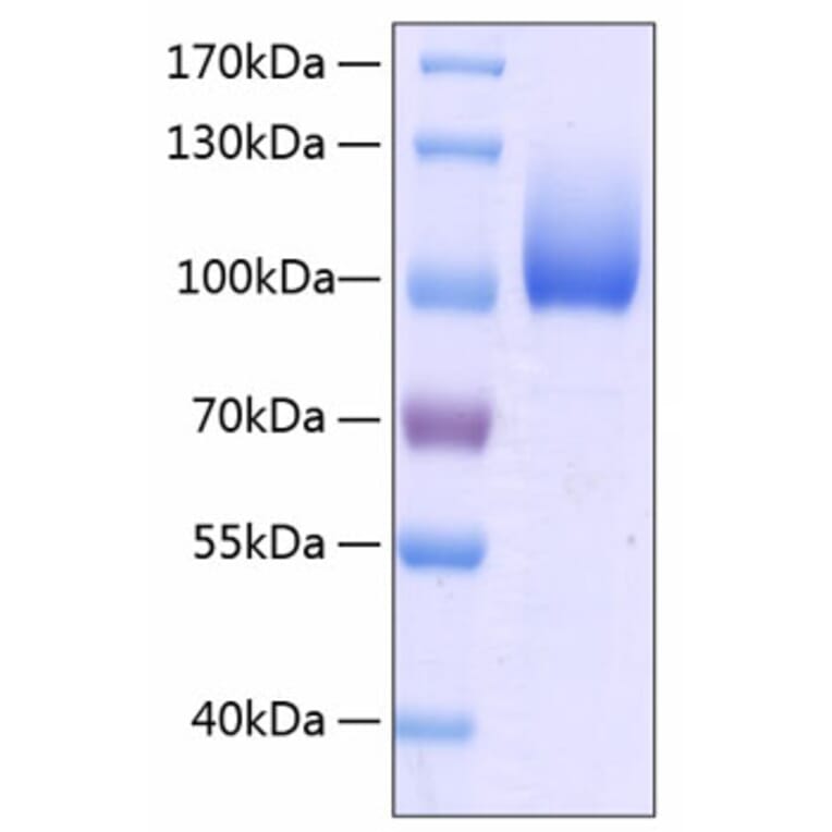 SDS-PAGE - Recombinant Human LIMPII Protein (C-terminal Human Fc and His Tag) (A331015) - Antibodies.com
