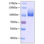SDS-PAGE - Recombinant Human LIMPII Protein (C-terminal Human Fc and His Tag) (A331015) - Antibodies.com