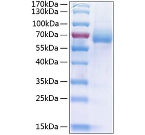 SDS-PAGE - Recombinant Human LIMPII Protein (C-terminal His Tag) (A331016) - Antibodies.com