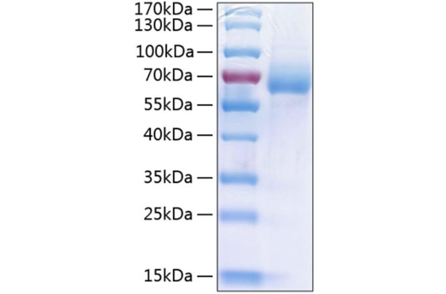 SDS-PAGE - Recombinant Human LIMPII Protein (C-terminal His Tag) (A331016) - Antibodies.com