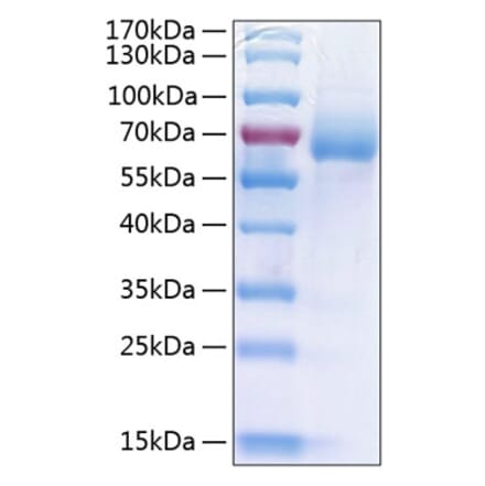 SDS-PAGE - Recombinant Human LIMPII Protein (C-terminal His Tag) (A331016) - Antibodies.com