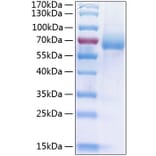 SDS-PAGE - Recombinant Human LIMPII Protein (C-terminal His Tag) (A331016) - Antibodies.com