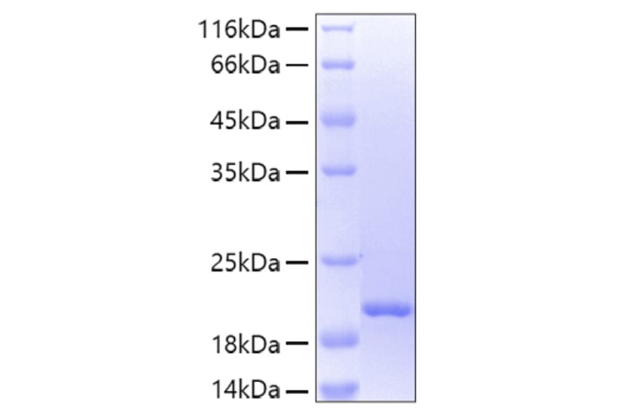 SDS-PAGE - Recombinant Human Lipocalin-2/NGAL Protein (A331017) - Antibodies.com