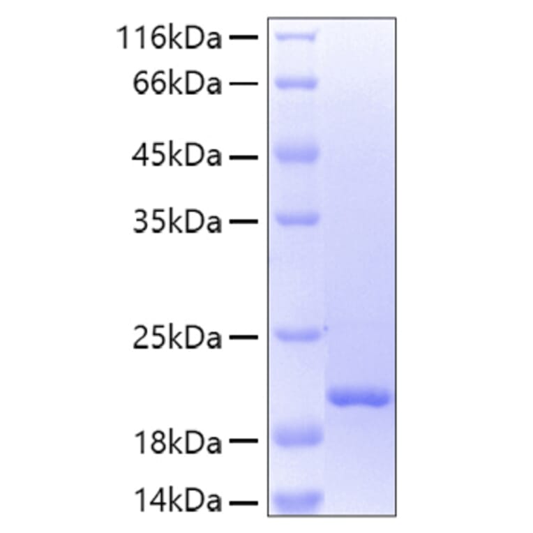 SDS-PAGE - Recombinant Human Lipocalin-2/NGAL Protein (A331017) - Antibodies.com