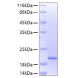 SDS-PAGE - Recombinant Human Lipocalin-2/NGAL Protein (A331017) - Antibodies.com