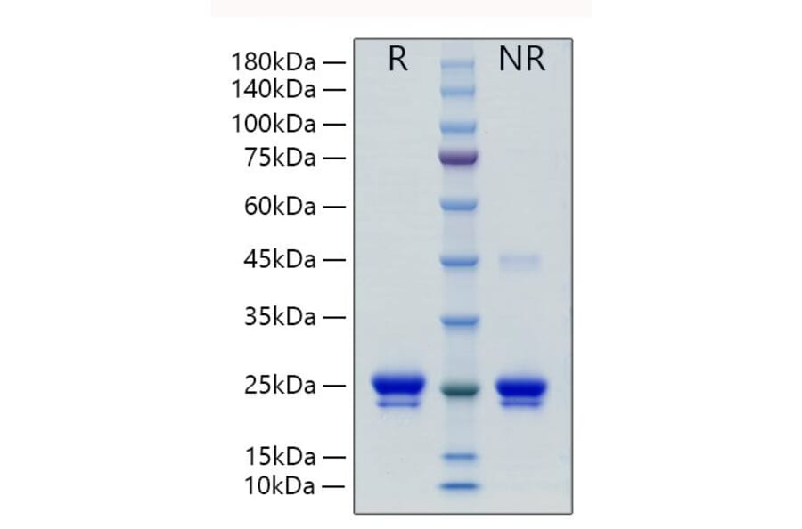 SDS-PAGE - Recombinant Human Lipocalin-2/NGAL Protein (C-terminal His Tag) (A331018) - Antibodies.com