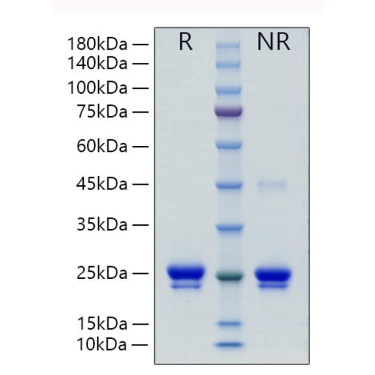 SDS-PAGE - Recombinant Human Lipocalin-2/NGAL Protein (C-terminal His Tag) (A331018) - Antibodies.com