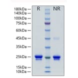 SDS-PAGE - Recombinant Human Lipocalin-2/NGAL Protein (C-terminal His Tag) (A331018) - Antibodies.com