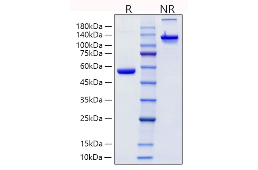SDS-PAGE - Recombinant Human Lipocalin-2/NGAL Protein (C-terminal Human Fc Tag) (A331019) - Antibodies.com