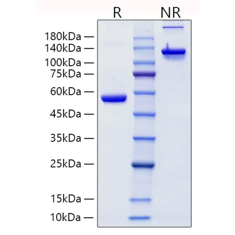 SDS-PAGE - Recombinant Human Lipocalin-2/NGAL Protein (C-terminal Human Fc Tag) (A331019) - Antibodies.com