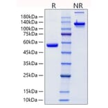 SDS-PAGE - Recombinant Human Lipocalin-2/NGAL Protein (C-terminal Human Fc Tag) (A331019) - Antibodies.com