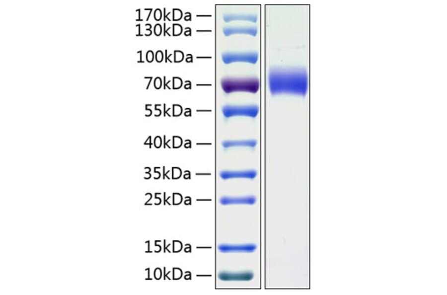 SDS-PAGE - Recombinant Human LMW Kininogen Protein (C-terminal His Tag) (A331020) - Antibodies.com