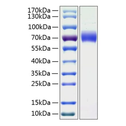 SDS-PAGE - Recombinant Human LMW Kininogen Protein (C-terminal His Tag) (A331020) - Antibodies.com