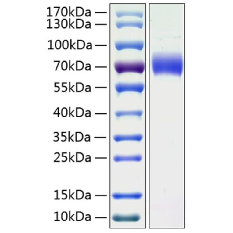 SDS-PAGE - Recombinant Human LMW Kininogen Protein (C-terminal His Tag) (A331020) - Antibodies.com