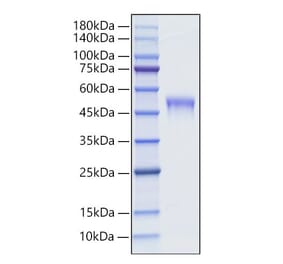 SDS-PAGE - Recombinant Mouse LRG1 Protein (C-terminal His Tag) (A331021) - Antibodies.com