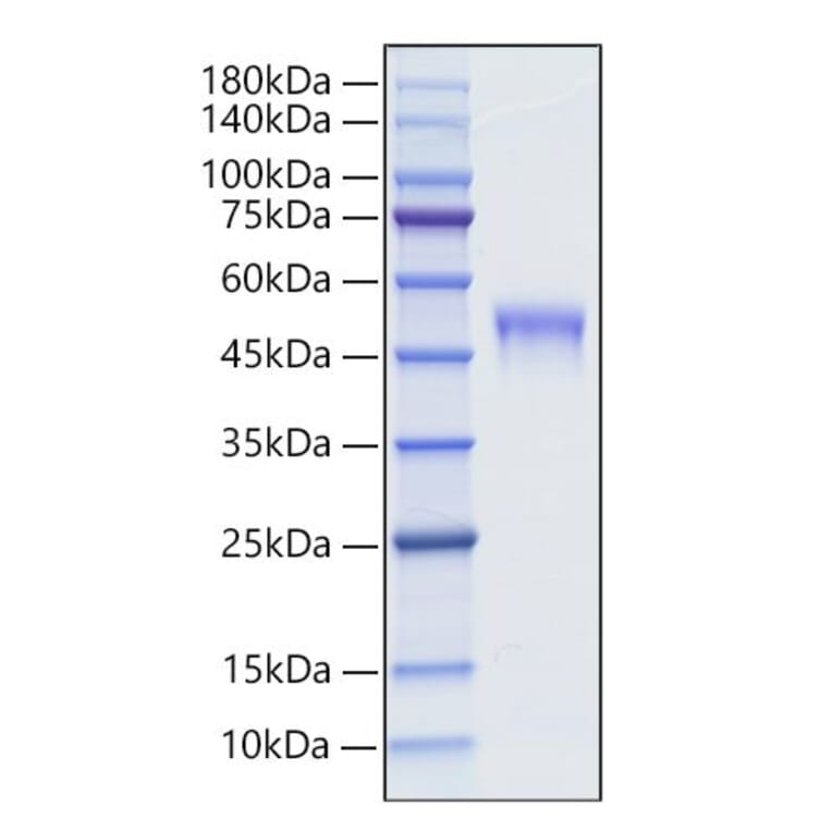 SDS-PAGE - Recombinant Mouse LRG1 Protein (C-terminal His Tag) (A331021) - Antibodies.com