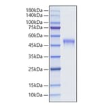 SDS-PAGE - Recombinant Mouse LRG1 Protein (C-terminal His Tag) (A331021) - Antibodies.com