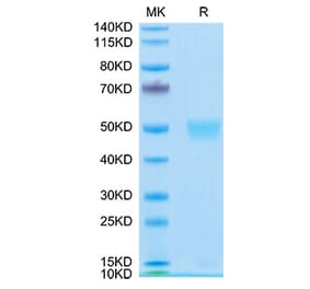 Tris-Bis PAGE - Recombinant Human LRG1 Protein (C-terminal His Tag) (A331022) - Antibodies.com