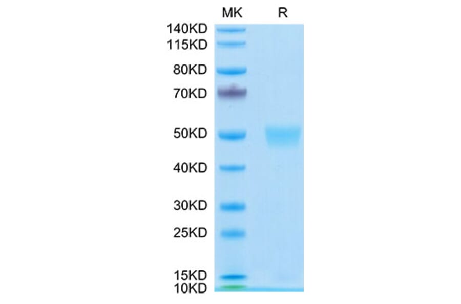 Tris-Bis PAGE - Recombinant Human LRG1 Protein (C-terminal His Tag) (A331022) - Antibodies.com