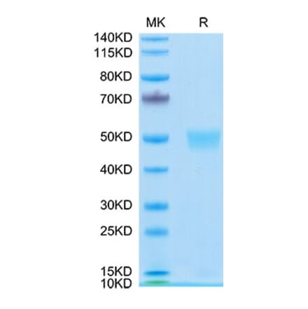 Tris-Bis PAGE - Recombinant Human LRG1 Protein (C-terminal His Tag) (A331022) - Antibodies.com