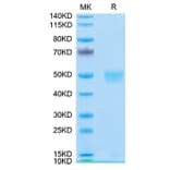 Tris-Bis PAGE - Recombinant Human LRG1 Protein (C-terminal His Tag) (A331022) - Antibodies.com