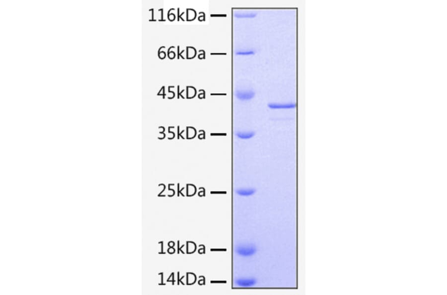 SDS-PAGE - Recombinant Human LRPAP1 Protein (C-terminal His Tag) (A331023) - Antibodies.com