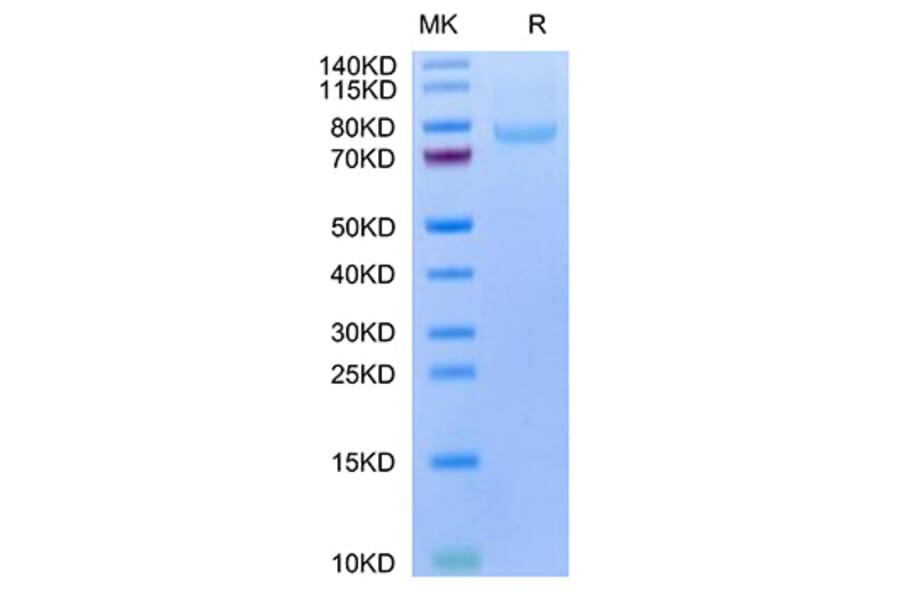 Tris-Bis PAGE - Recombinant Human LRRC15 Protein (C-terminal His and Avi Tag) (A331024) - Antibodies.com